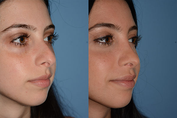 client