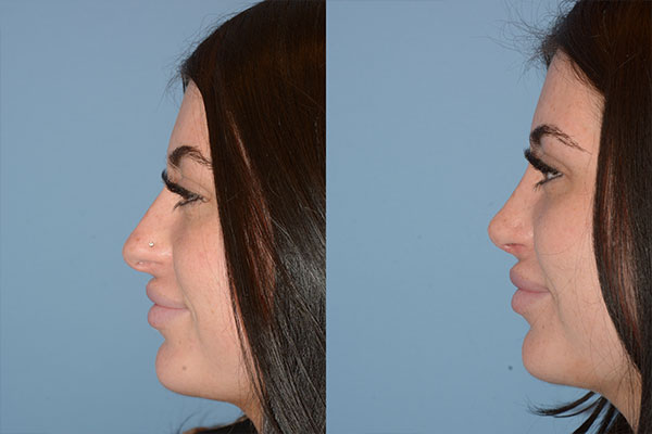 client