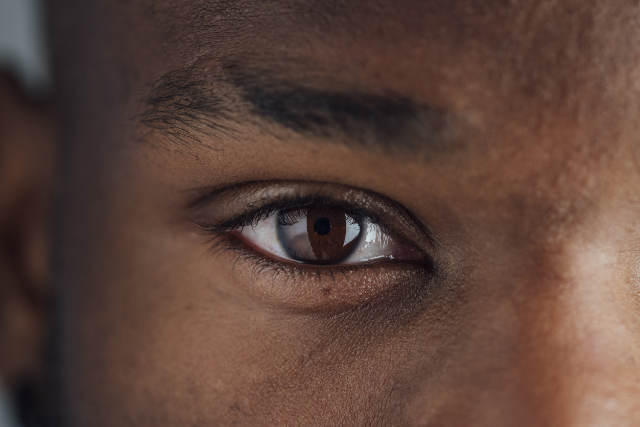 NYC man who got an upper eyelid surgery in NYC with Dr. Robert Guida.