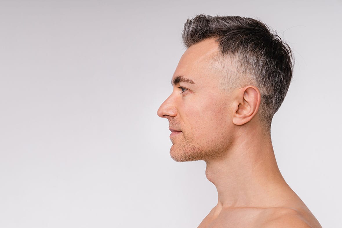 What Every Man Should Know Before Getting Rhinoplasty