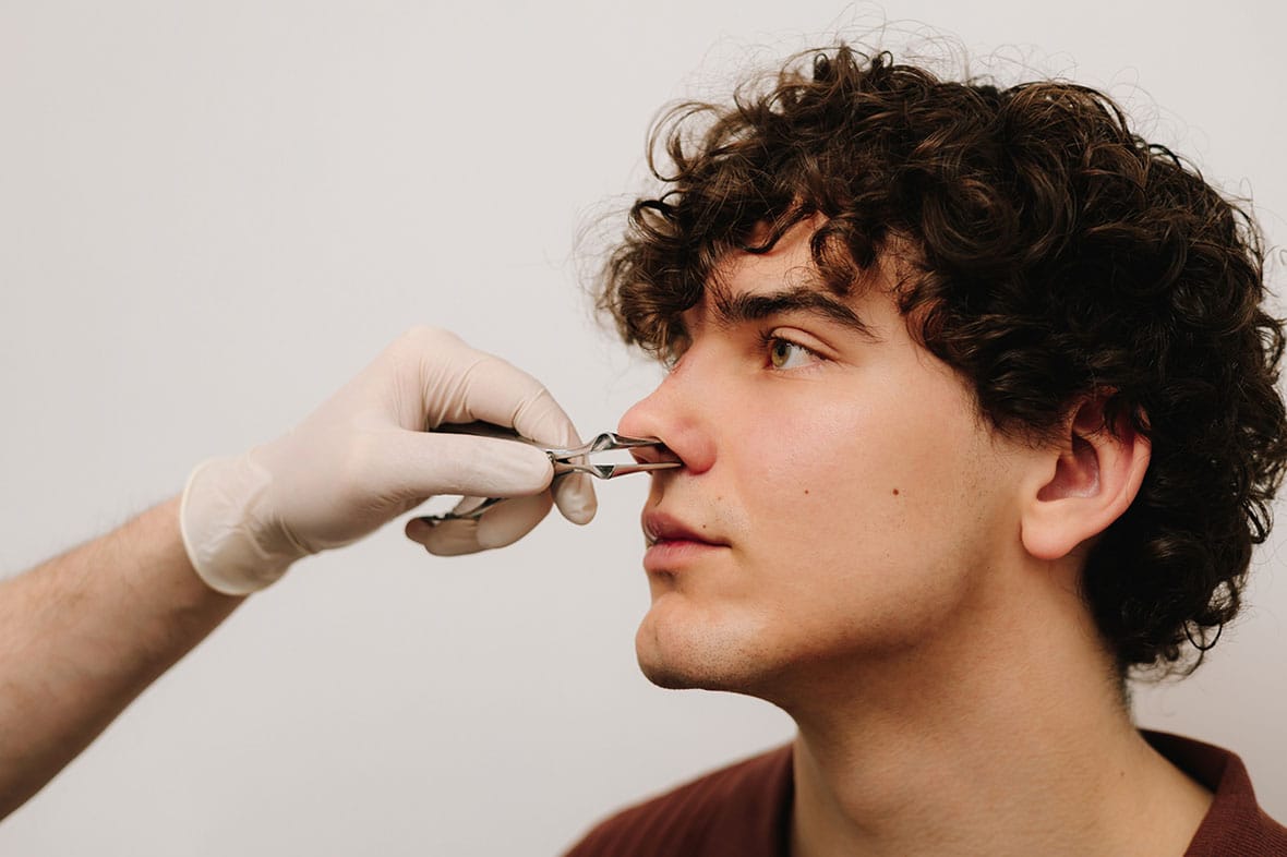 man getting a male rhinoplasty consultation in NYC